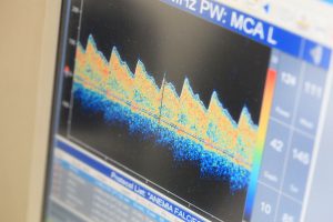 Imagem gerada durante exame mostra velocidade do sangue no cérebro. Foto: Bruna Carvalho. 